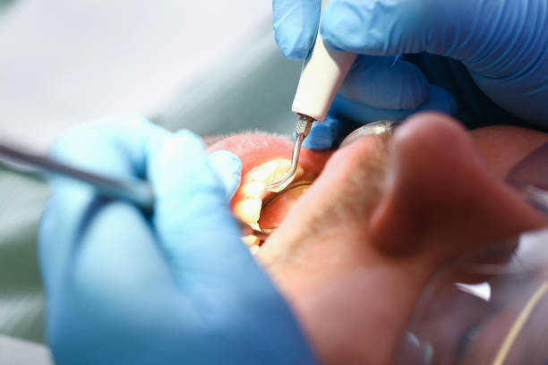 Best Emergency Treatment for Toothache in Santa Ana, CA